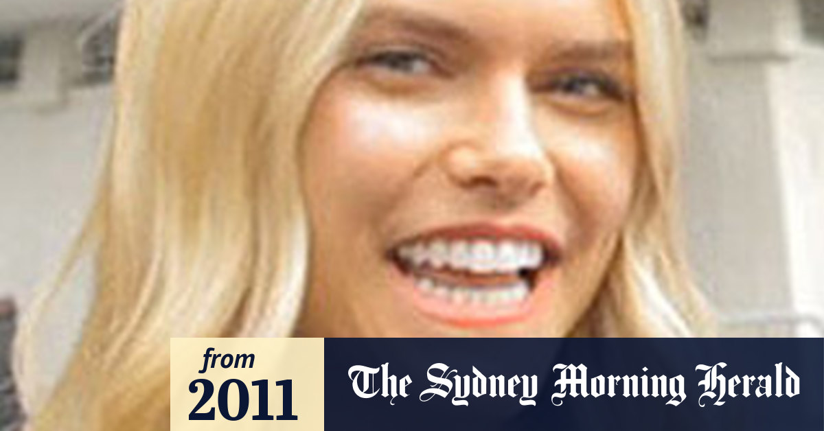 Model and exGossip Girl stylist loses hand in freak accident